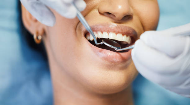 Best Emergency Tooth Extraction in Anton, TX